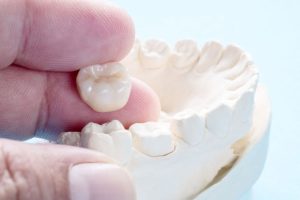 Now Don’t Worry About Your Teeth Problems With Affordable Dental Crowns