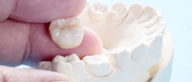 Now Don’t Worry About Your Teeth Problems With Affordable Dental Crowns